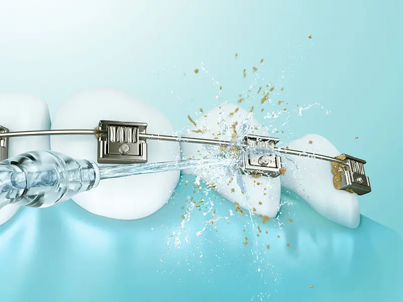 Máy tăm nước Panasonic EW1511 W